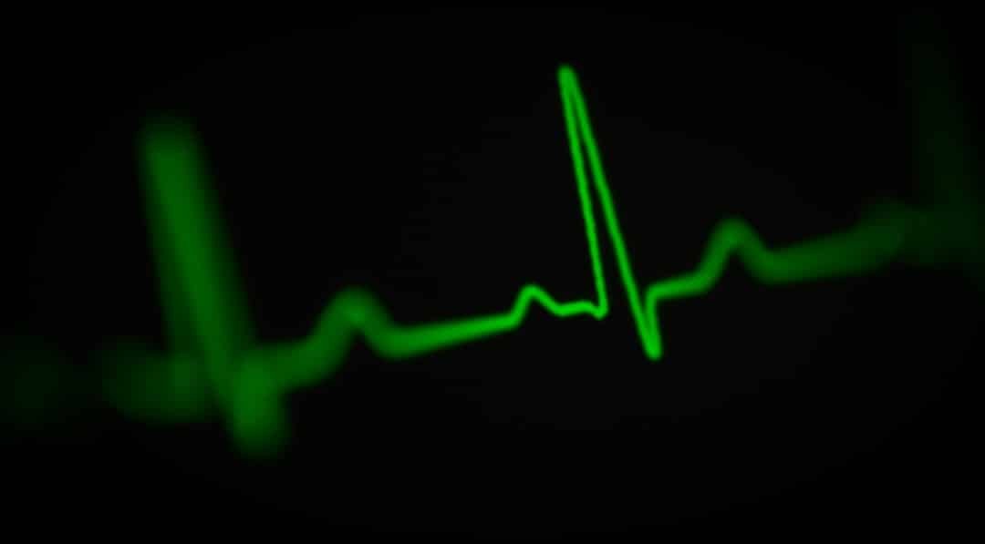 Photo Heart monitor