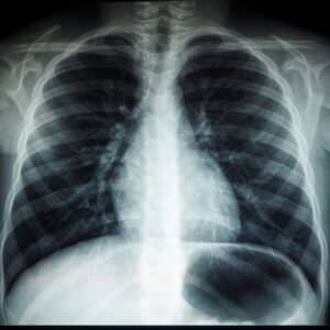 Photo Medical imaging