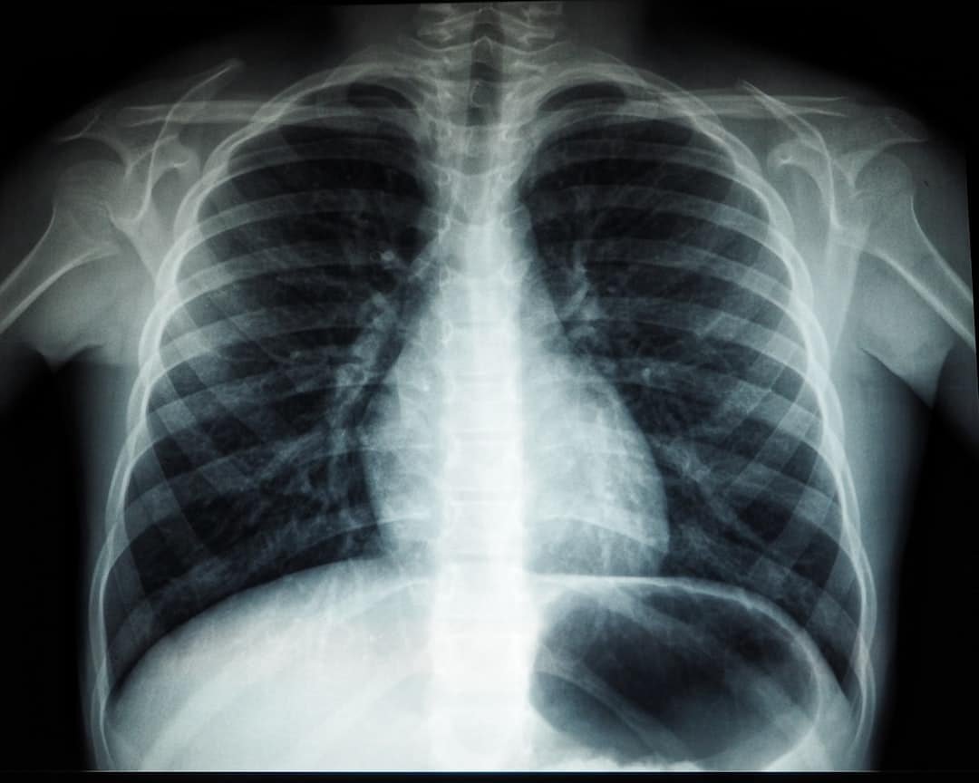 Photo Medical imaging